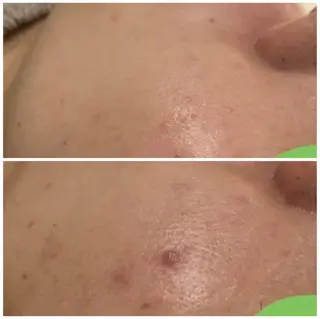 皮膚科で治らない肌へ lアクール 池袋店のエステ・リラクイメージ