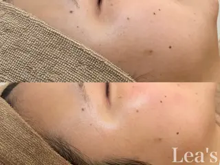 Lea's所属・【Lea's 】 hazukiのエステ・リラクイメージ