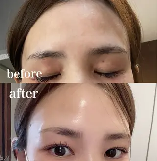 MY FAIR LADY所属・毛穴に特化したサロン MYFAIRLADYのエステ・リラクイメージ