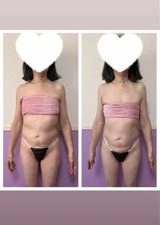 Miel所属・バストアップサロン Mielのエステ・リラクイメージ