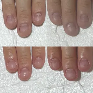 ネイル 自爪育成・巻き爪 補正講師　津蔵のネイルデザイン