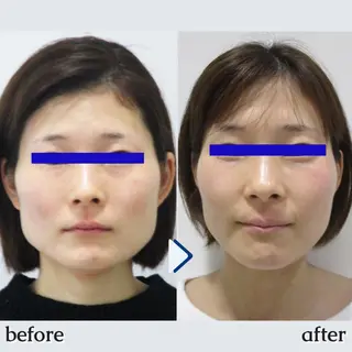 銀座美.design 博多駅前店のエステ・リラクイメージ