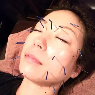 むくみたるみ専門☆ 美容鍼・小顔矯正のエステ・リラクイメージ