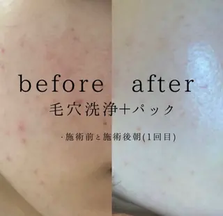 肌質改善サロン🌻 Nico laughのエステ・リラクイメージ