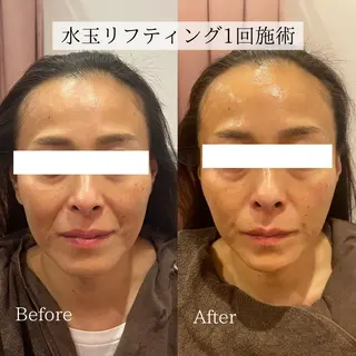 小顔美肌：ミアンカ 京阪モール本館1Fのエステ・リラクイメージ