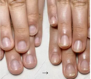 ネイル スマイルニコ Aiのネイルデザイン