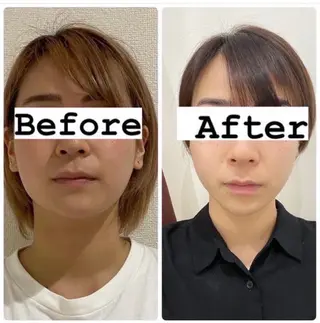 秒速小顔所属・秒速小顔 岩邊のその他イメージ