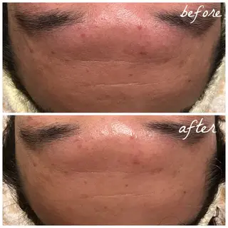 メンズ メナード岐阜市茜部 杉浦のエステ・リラクイメージ