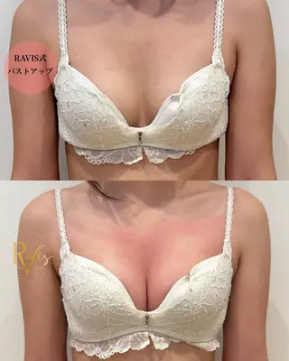 beautysalon RAVIS所属・東大阪/韓国肌管理/ 痩身バスト専門店のエステ・リラクイメージ