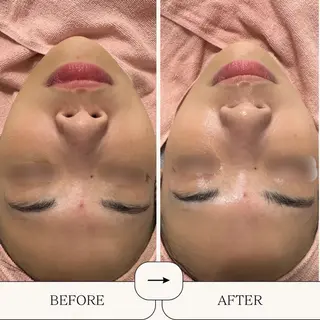 BestBelleꕤ 大阪福島/肌質改善のエステ・リラクイメージ