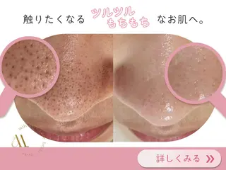 毛穴ケア専門サロン miliのエステ・リラクイメージ