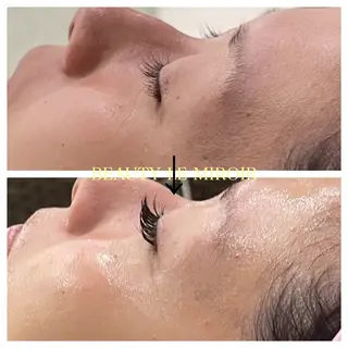 ビューティー ミロワールのエステ・リラクイメージ