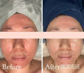 アンド ミルルのエステ・リラクイメージ