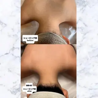 子供脱毛専門サロンReme【リミー】所属・添田 彩葉のエステ・リラクイメージ