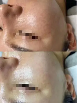 aliaハイフ&水光ジェットサロン所属・aliaハーブ水光店 エステティシャン募集のエステ・リラクイメージ