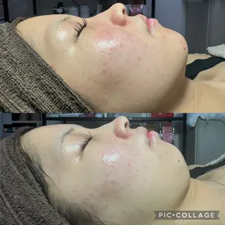 エステ✖️ネイル Feelのネイルデザイン