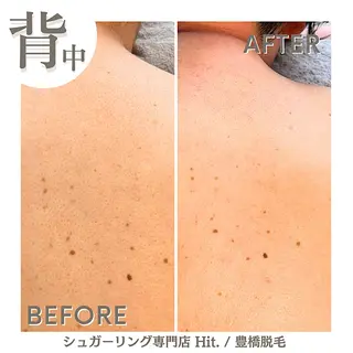 Hit. シュガーリング豊橋のエステ・リラクイメージ