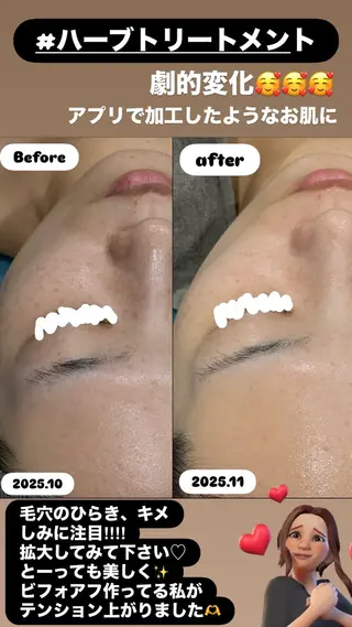 LiZA エステティックサロンのエステ・リラクイメージ