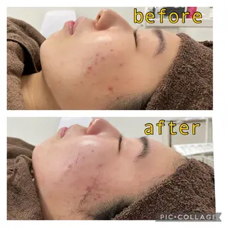 total beauty salon RIRE所属・古川 弥生のエステ・リラクイメージ