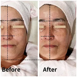 自然派フェイシャル やながわのエステ・リラクイメージ