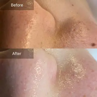 Mandarin Orange所属・毛穴から始める肌メン テマンダリンオレンジのエステ・リラクイメージ