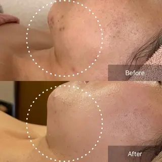 堀井 舞琳のエステ・リラクイメージ