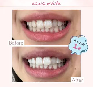 セルフホワイトニングエクシア小山店所属・セルフホワイトニング エクシア小山店のその他イメージ