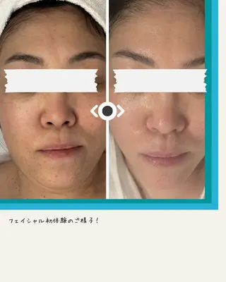 POLA Lisa 南船場/丸のエステ・リラクイメージ