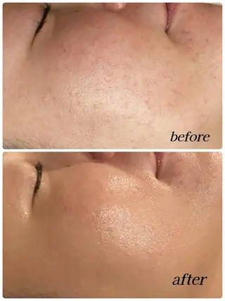 NAVI 韓国肌管理所属・NAVI韓国肌管理《 毛穴/艶肌/小顔》のエステ・リラクイメージ