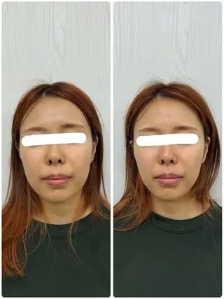 美容鍼×小顔矯正 ×美容整体　浜川泰仁のエステ・リラクイメージ