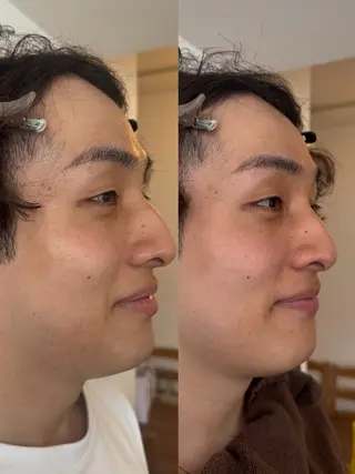 辻 有希音のエステ・リラクイメージ