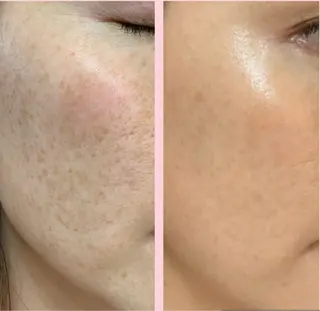 Safari Bloom所属・Safari Bloomのエステ・リラクイメージ