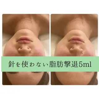 次世代痩身 人生最後のダイエットのエステ・リラクイメージ