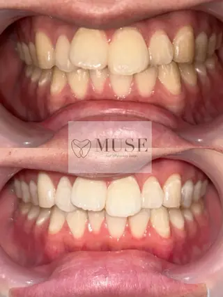 セルフホワイトニングサロンMUSE所属・セルフホワイトニング MUSE🫧焼津のその他イメージ