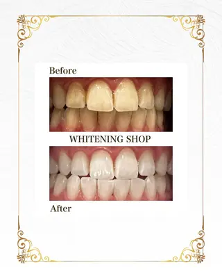 ホワイトニングショップ静岡葵区店所属・ホワイトニング ショップ葵区静岡駅店のその他イメージ