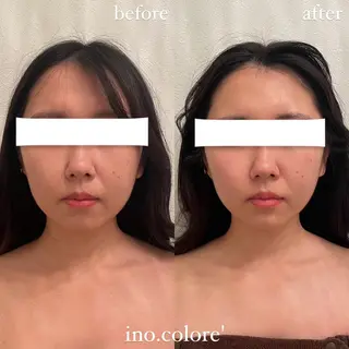 エステサロンino.colore'所属・小顔サロン ino.coloreのエステ・リラクイメージ