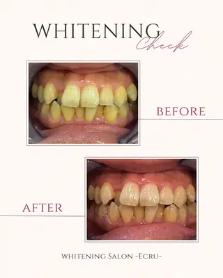 ホワイトニングサロン Ecru所属・ホワイトニングサロン Ecru エクリュのその他イメージ