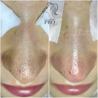 毛穴肌育専門店 リールのエステ・リラクイメージ