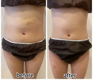 💎インディバ GEM💎indiba   healing room GEM所属・💎 GEM💎のエステ・リラクイメージ