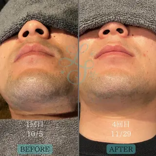 メンズ LuminaStella所属・VIO脱毛＆SPA ルミナステラのエステ・リラクイメージ