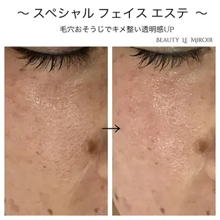 ビューティー ミロワールのエステ・リラクイメージ