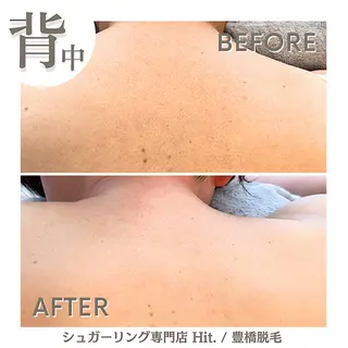 Hit. シュガーリング豊橋のエステ・リラクイメージ