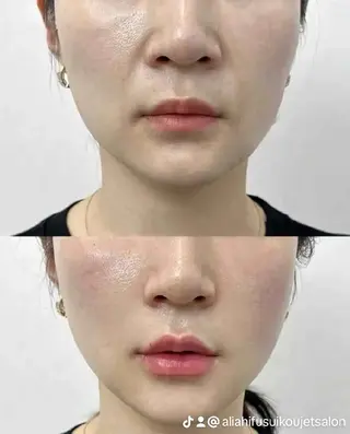 マツエク・マツパ aliaハイフ&水光ジェットサロン所属・aliaハーブ水光店 エステティシャン募集のエステ・リラクイメージ