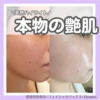 Dimples所属・Dimples ERINAのエステ・リラクイメージ