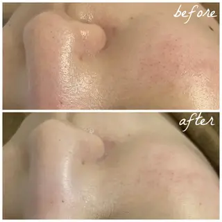 メンズ メナード岐阜市茜部 杉浦のエステ・リラクイメージ