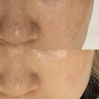 吉祥寺エステサロン Orangeのエステ・リラクイメージ