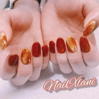 ネイル Nail×Lani 深爪矯正対応◎のネイルデザイン
