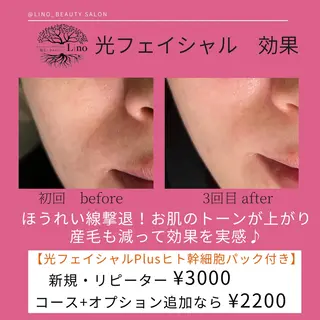 マツエク・マツパ アイブロウ Lino 《リノ》のエステ・リラクイメージ