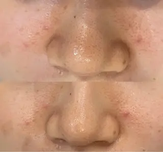 DeI'm   名古屋栄所属・小林 玲菜のエステ・リラクイメージ