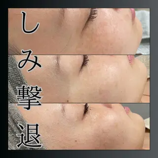 LiZA エステティックサロンのその他イメージ